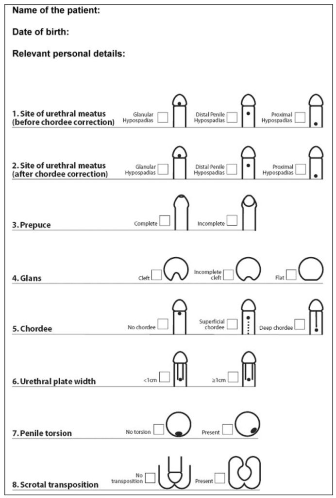 General classification hypospadias