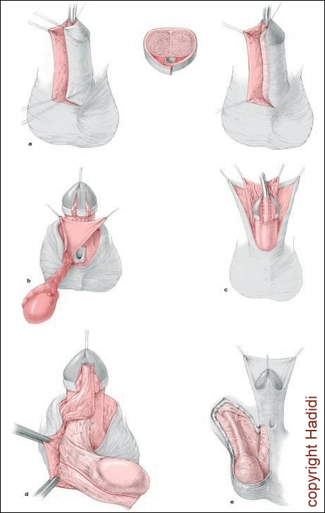 Schützende Zwischenschichten