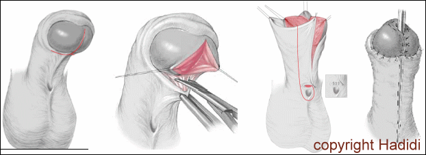 LAB Technique Drawing