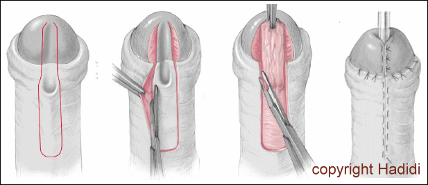 SLAM Technique Drawing